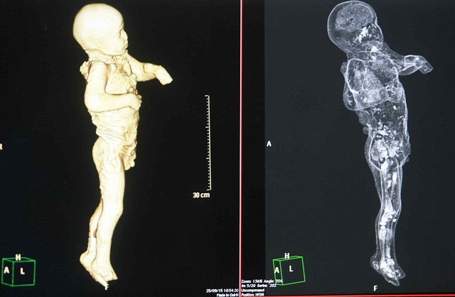 庞贝古城木乃伊接受CT扫描 死前惊恐表情曝光