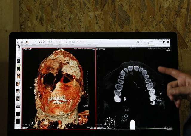 庞贝古城木乃伊接受CT扫描 死前惊恐表情曝光