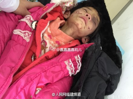 女童校外托管全身伤痕 老师劝家长不要孩子(图)