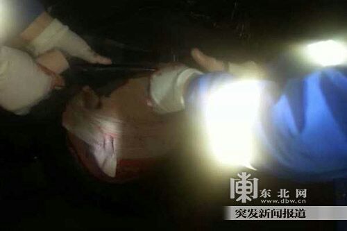 姐弟俩遛弯无缘无故被人捅 弟弟受伤致肾摘除