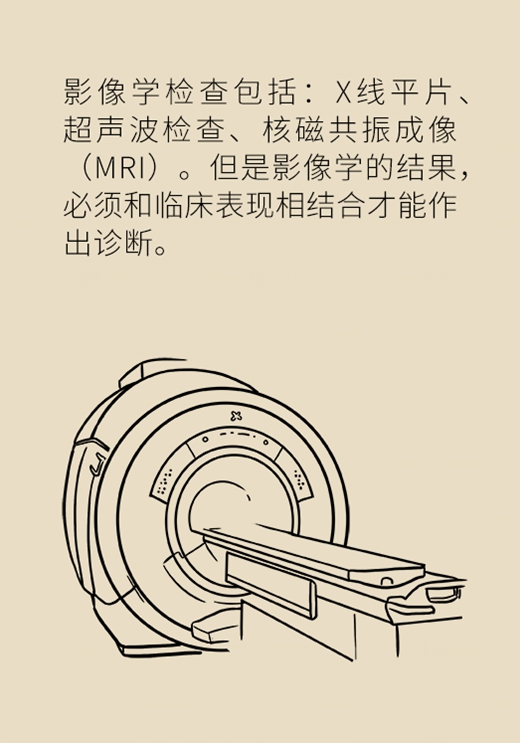 穿高跟鞋竟然穿出脚“肿瘤”，这些症状你有没有？