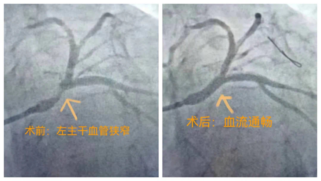 （转载）西安大兴医院：5G加持，看心内科如何“速”效救“心”