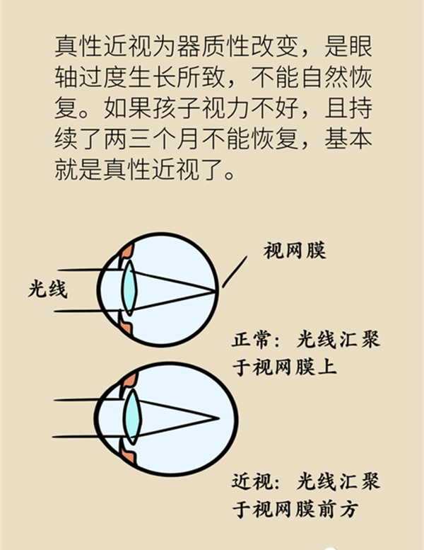 孩子近视了还能恢复正常吗？5招教你延缓度数增长