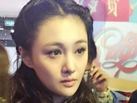 郑爽杨紫任娜英 女星最爱整的部位鼻子成重灾区