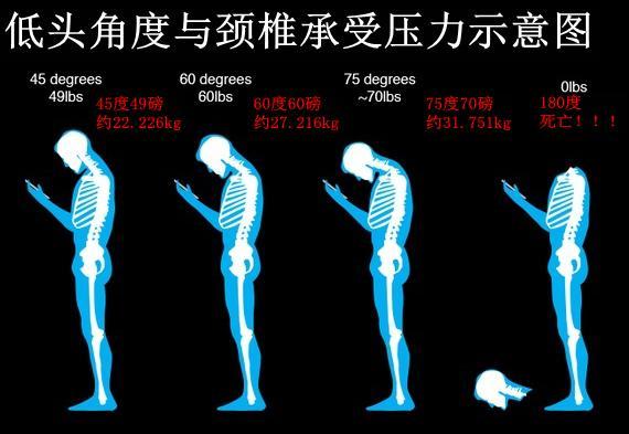 【焦点图】【即时快讯】警惕“手机脖”！长时间玩手机的正确姿势，你get到了吗？